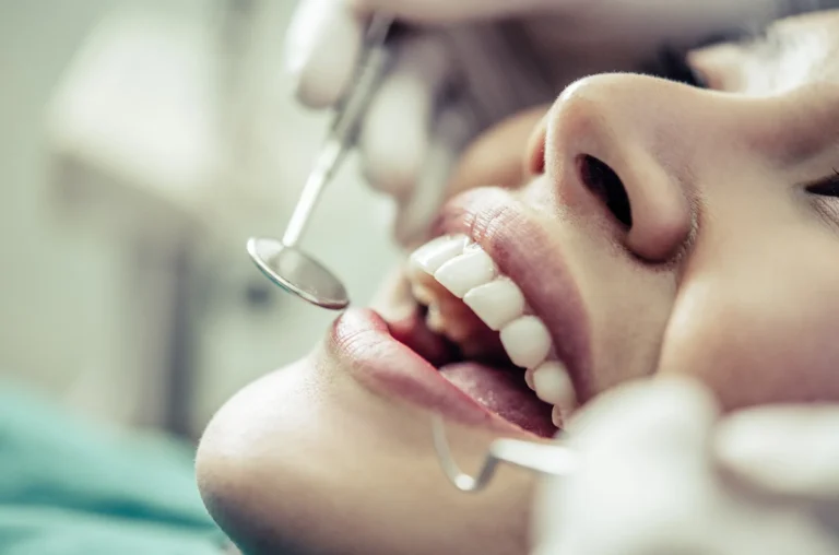 أفضل أنواع تلبيسة الأسنان