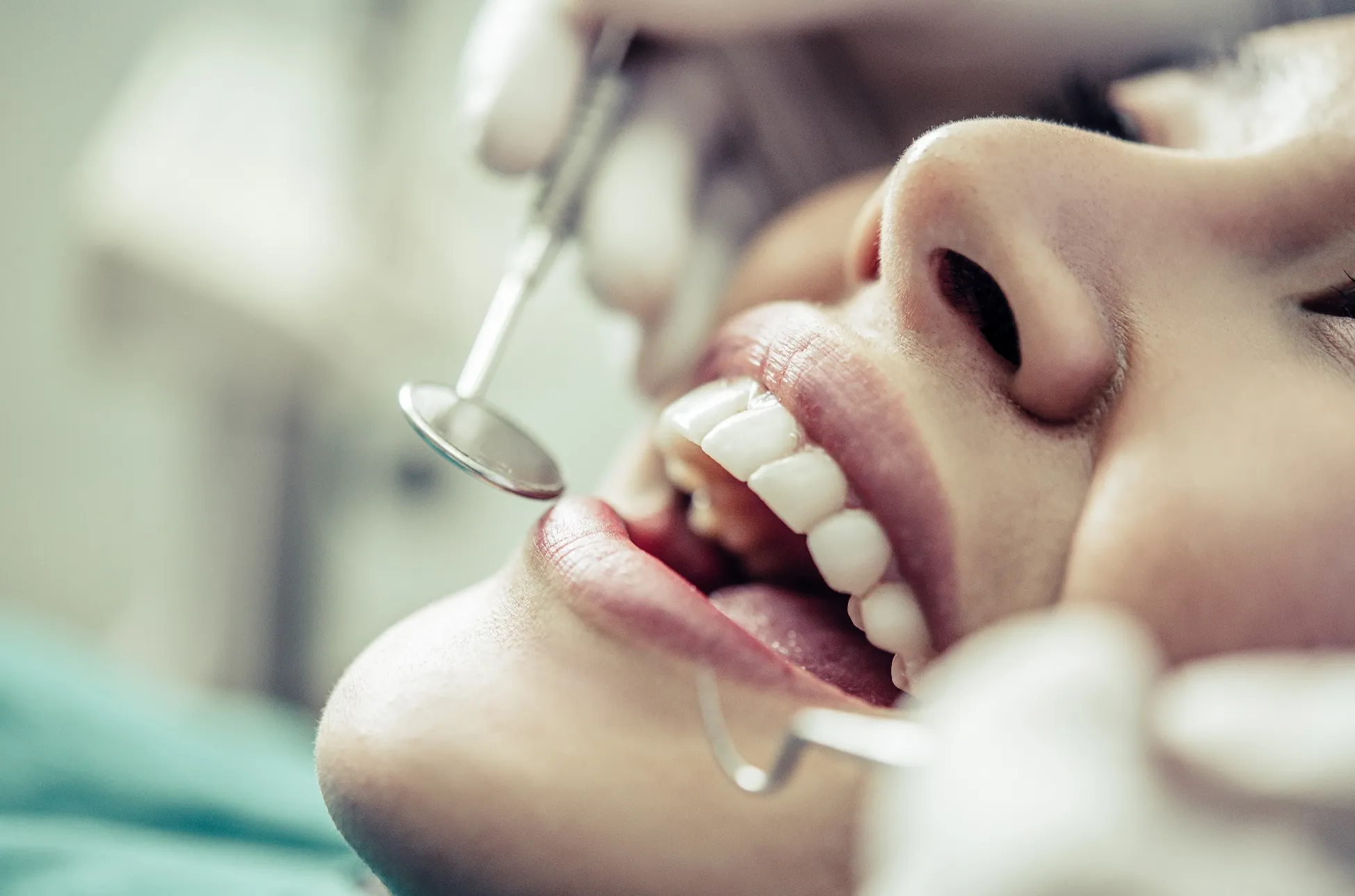 أفضل أنواع تلبيسة الأسنان