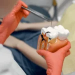 مراحل زراعة الاسنان