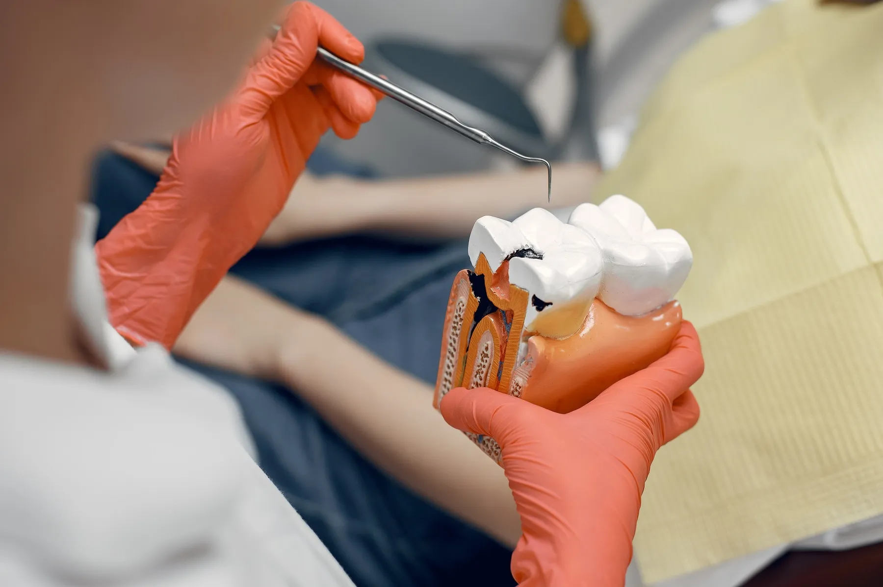 مراحل زراعة الاسنان