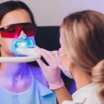 تجميل الاسنان بالليزر