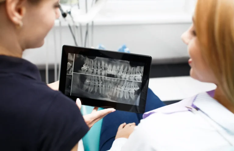 ضرس العقل المدفون