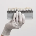 الفينير واللومنير