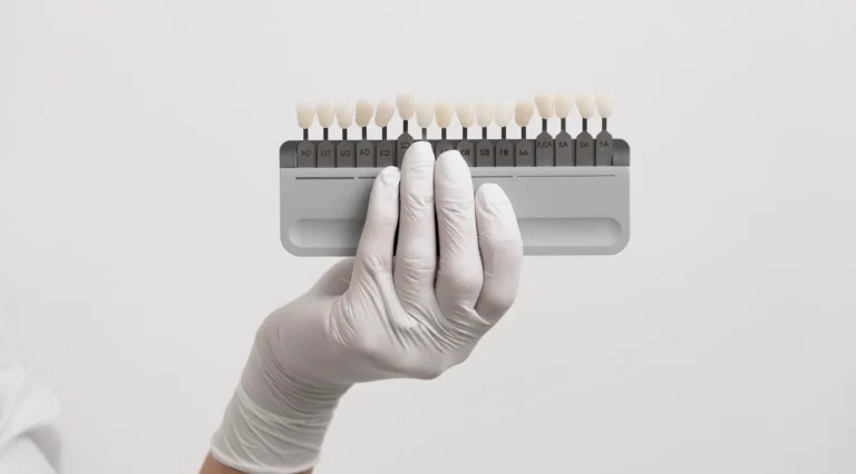 الفينير واللومنير