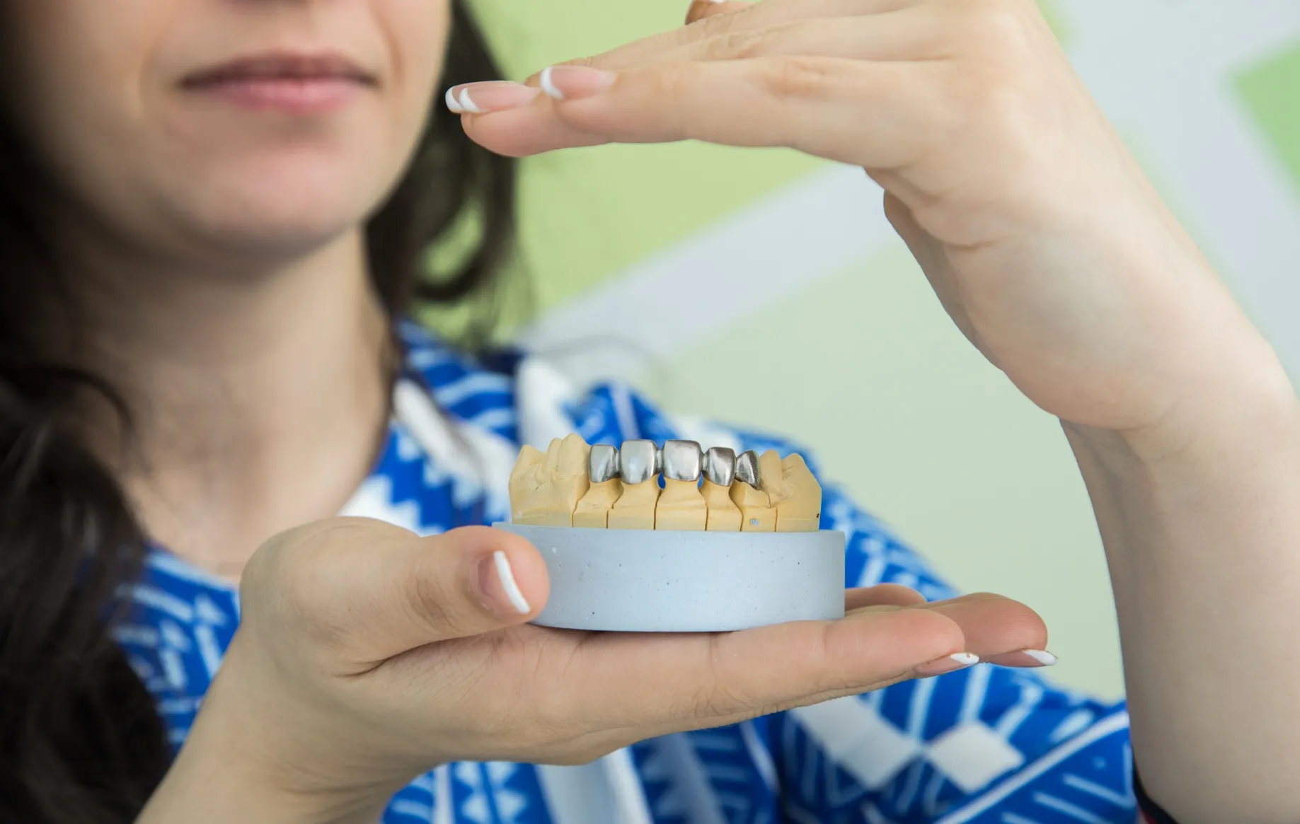 تركيب العدسات التجميلية للأسنان الفينير واللومنير