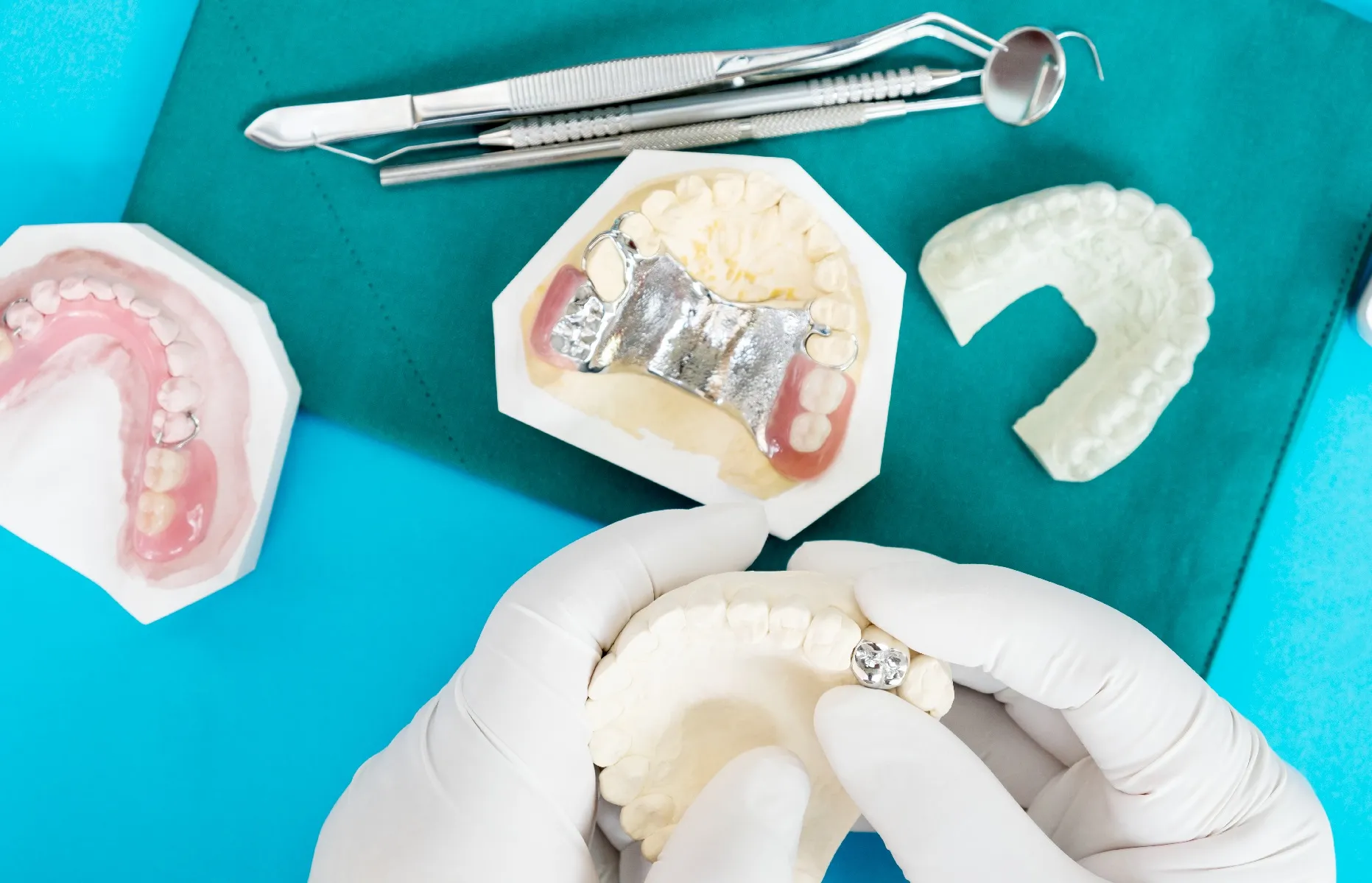 أفضل أنواع زراعة الأسنان