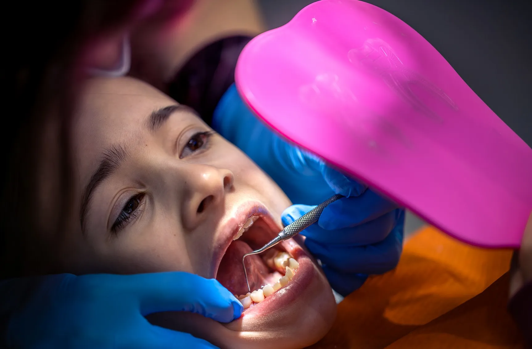 العدسات التجميلية للأسنان