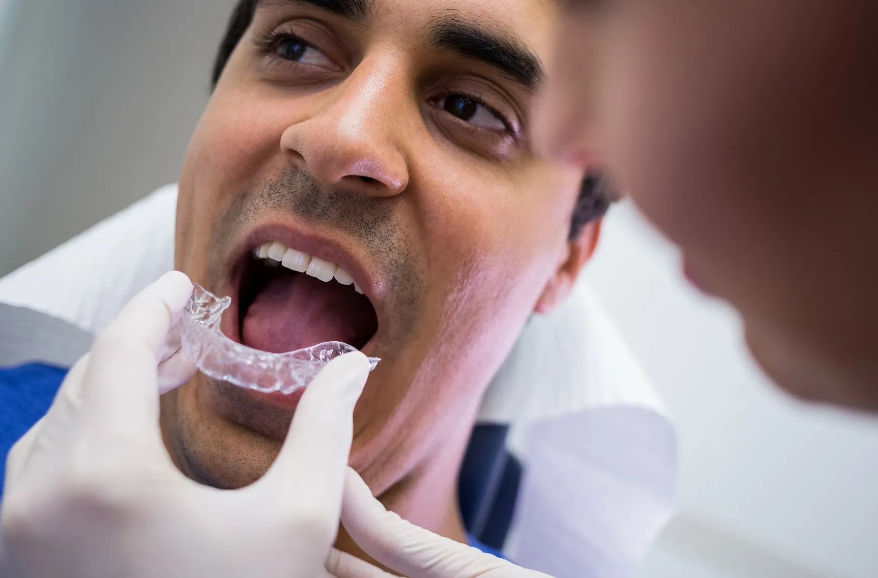 الفك المعوج