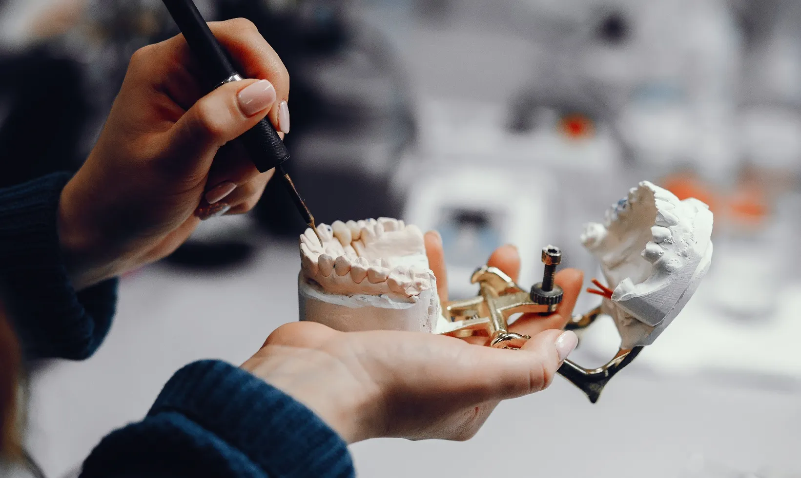 تجميل وتعديل اللثة