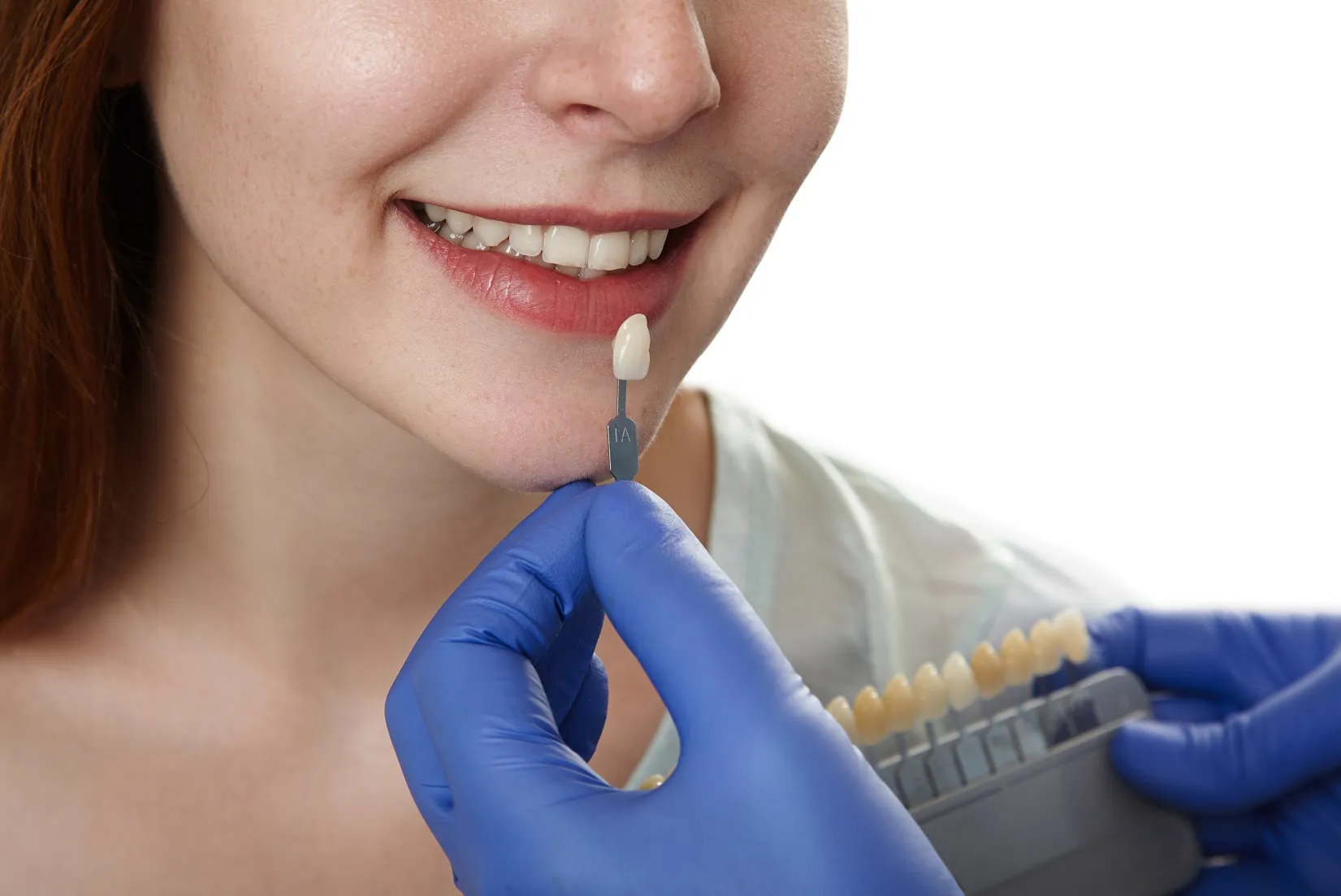 زراعة الأسنان بدون جراحة