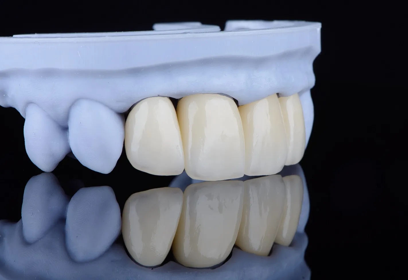 زراعة الأسنان