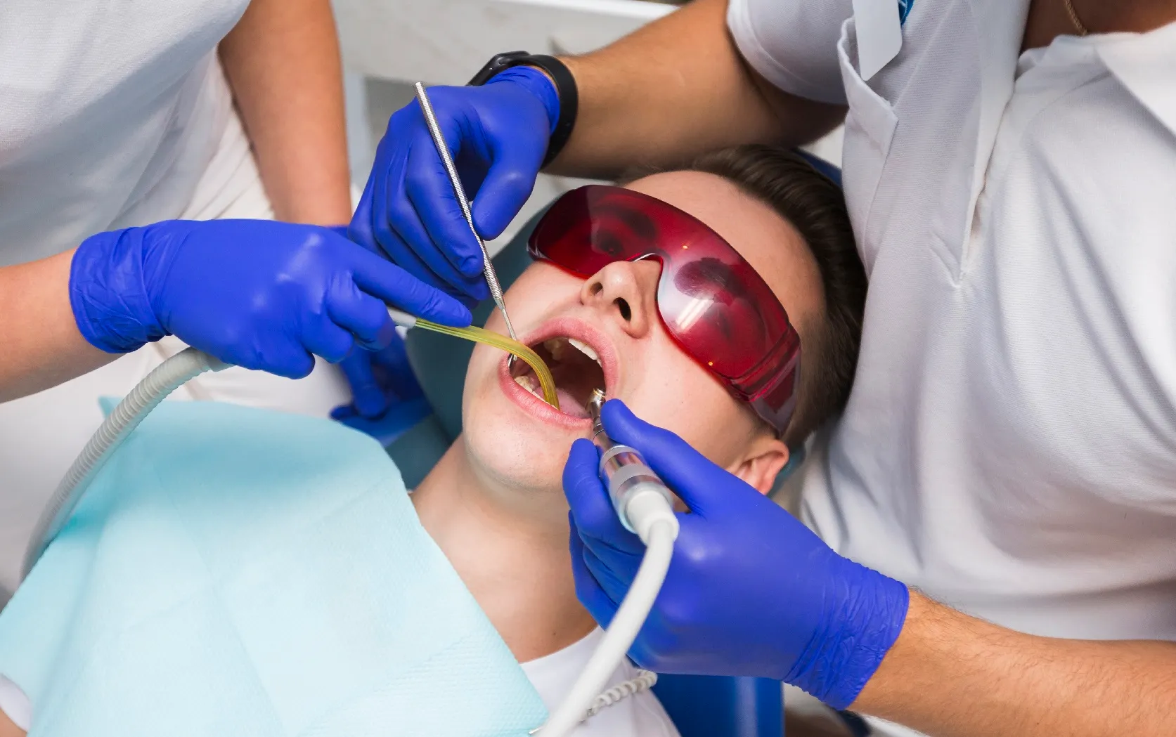 علاج الاسنان بالليزر