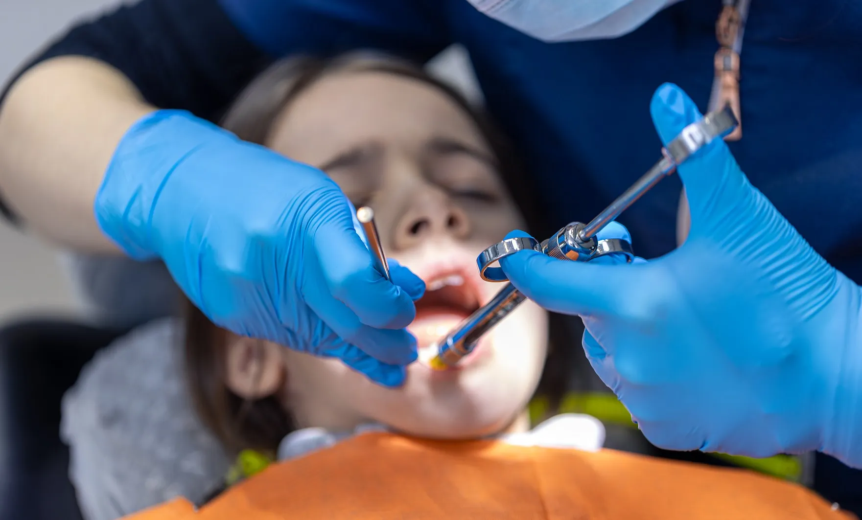 علاج تسوس أسنان الأطفال