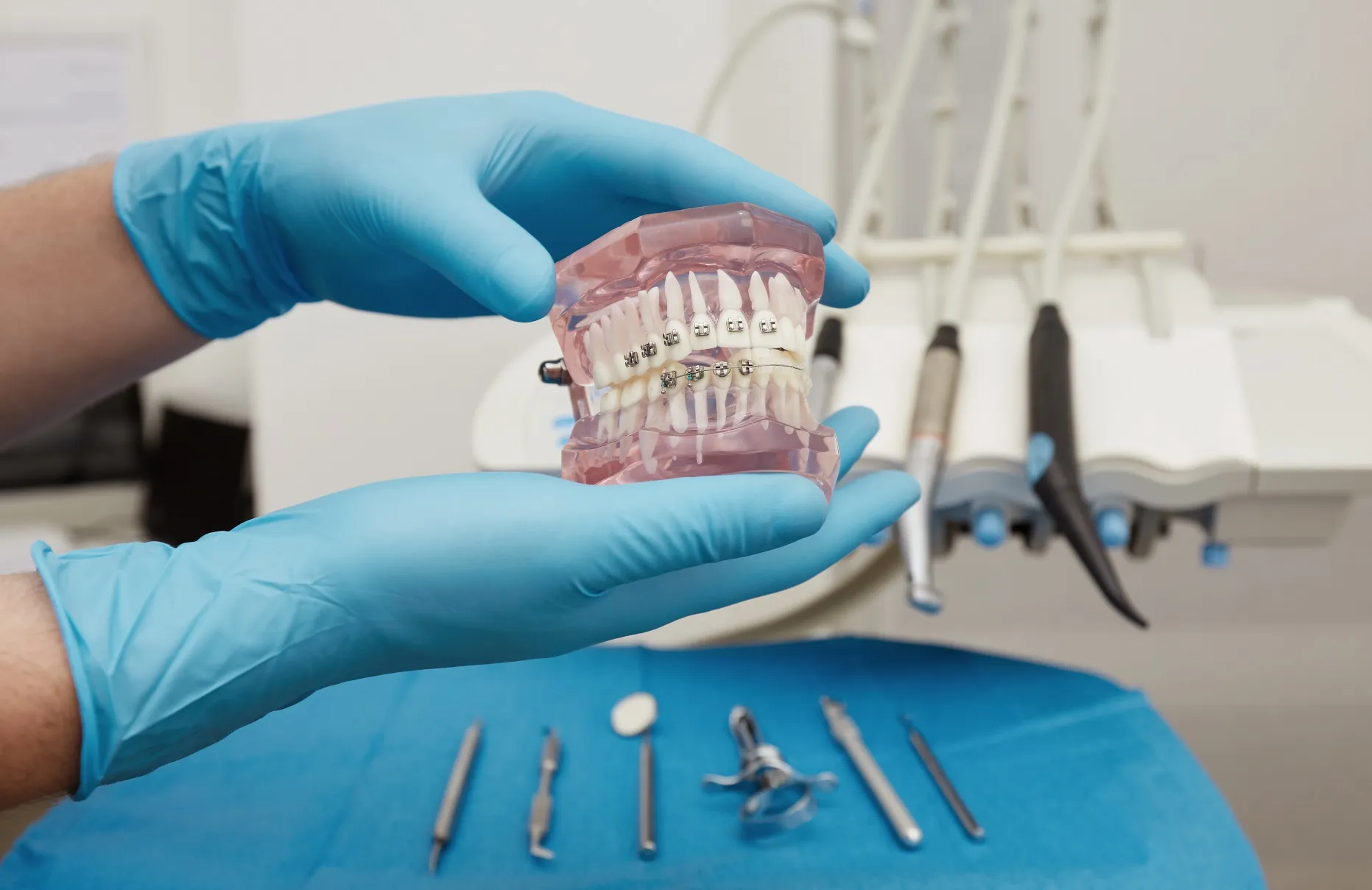 عملية زراعة الاسنان