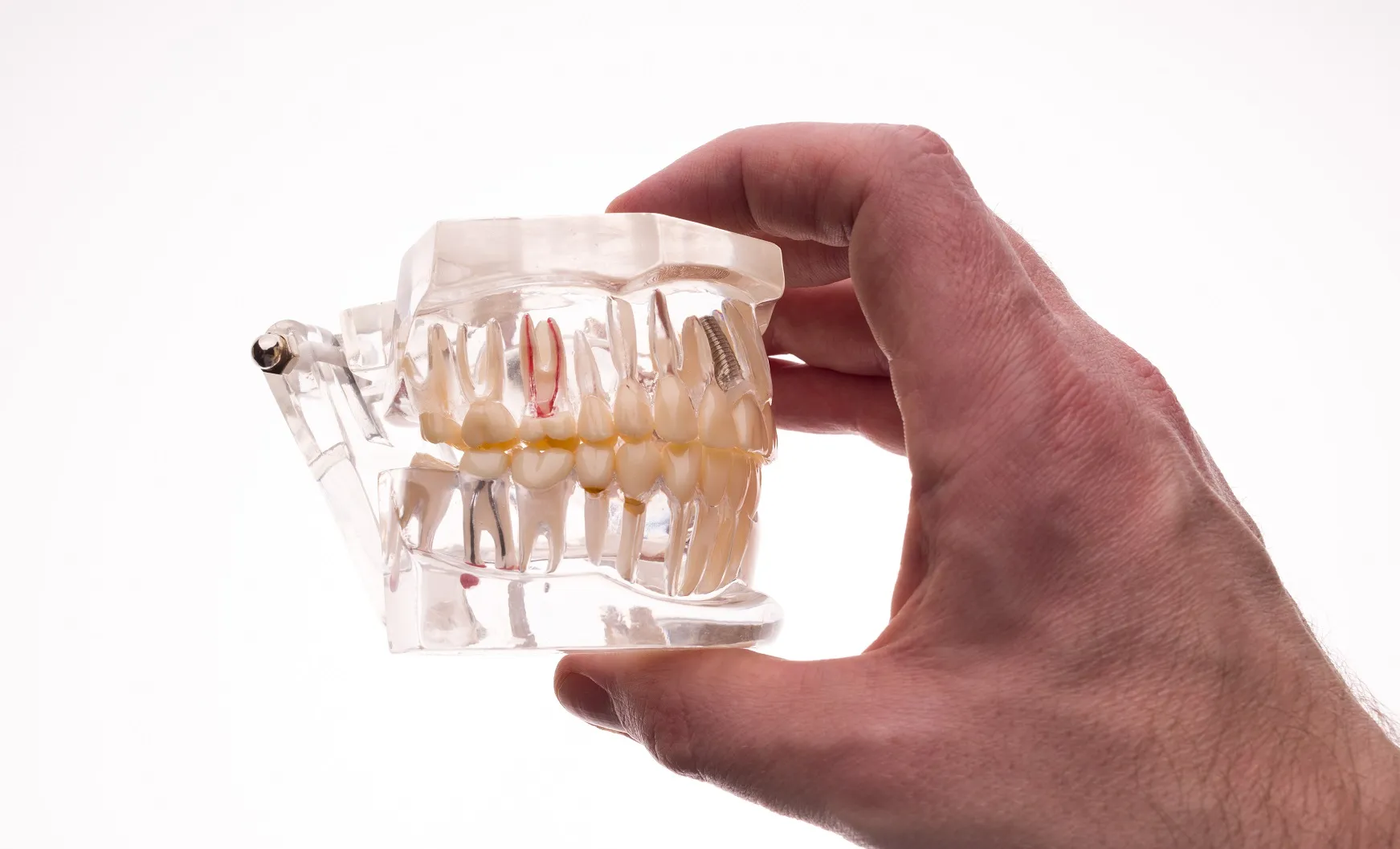 فوائد ضرس العقل الخفية