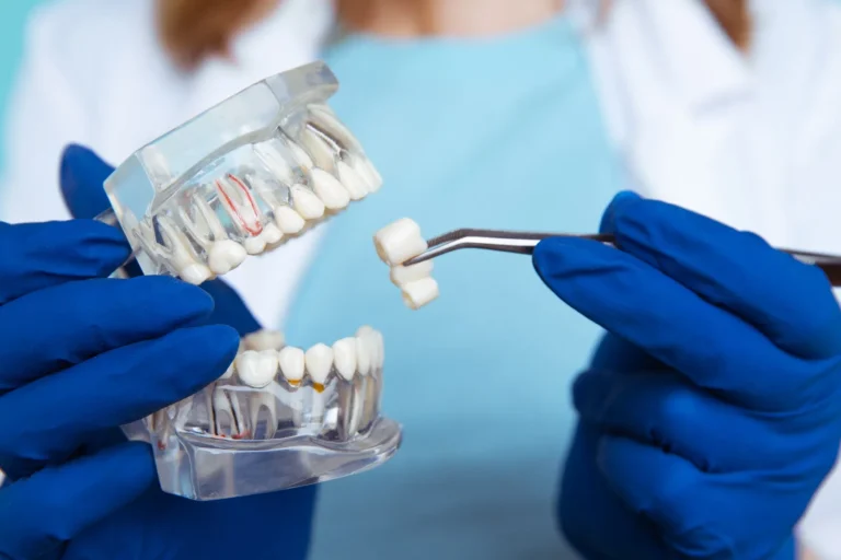 مرضى زراعة الأسنان