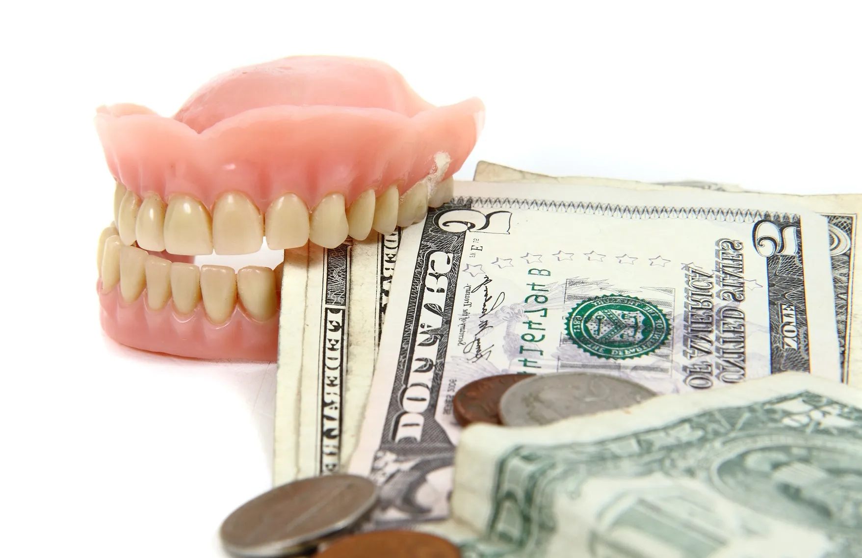 أسعار زراعة الأسنان