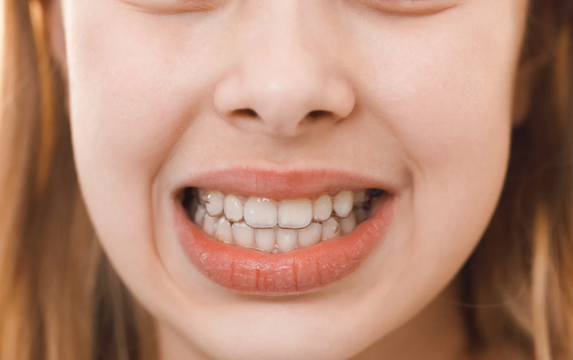 اعراض أمراض الأسنان