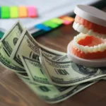 تكلفة زراعة الأسنان في الرياض