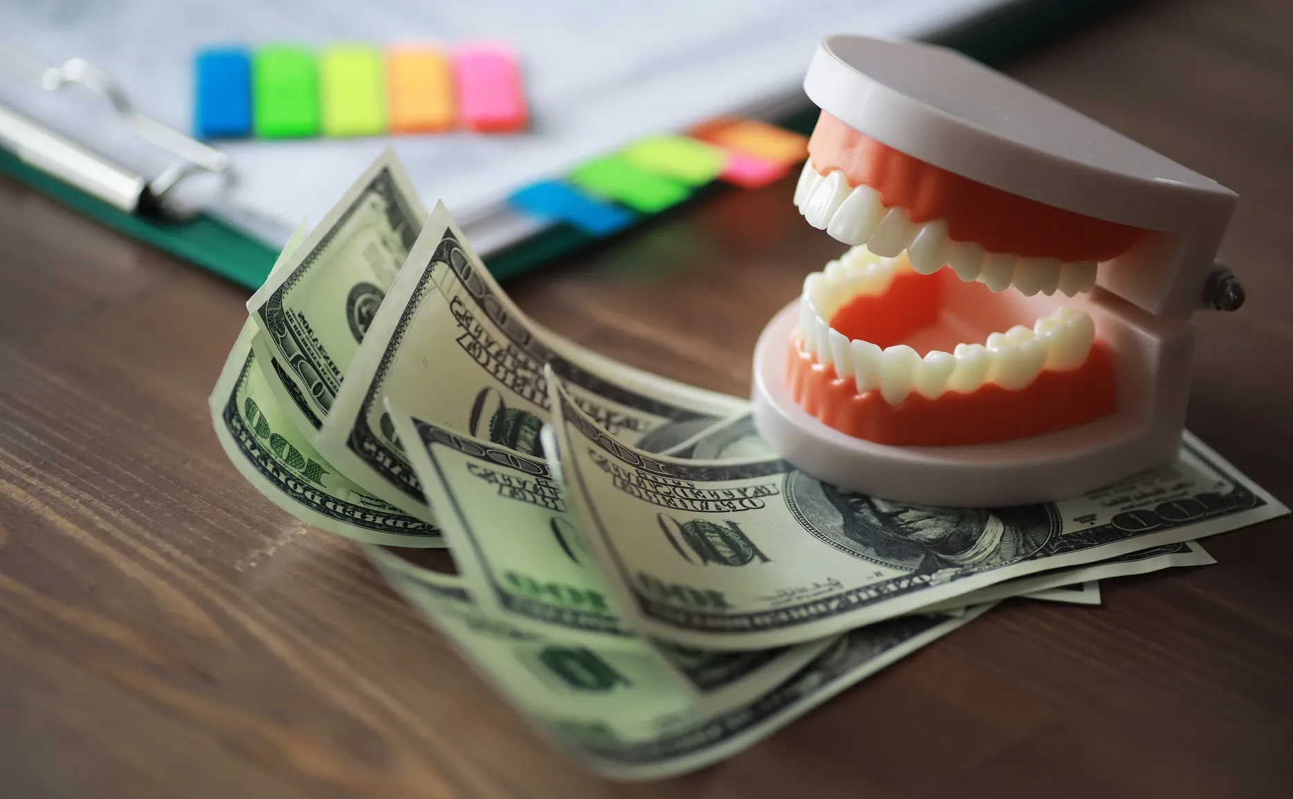 تكلفة زراعة الأسنان في الرياض