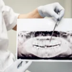 أمراض الأسنان