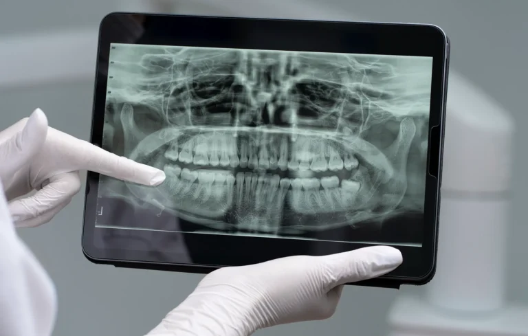 اشعة بانوراما الاسنان