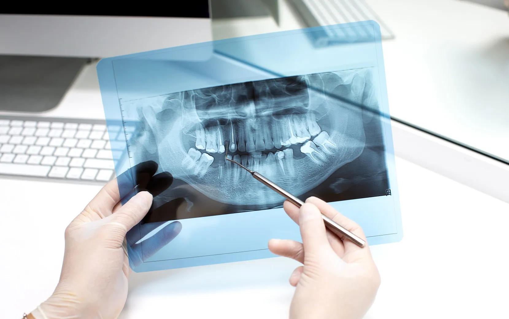 التصوير البانورامي للأسنان