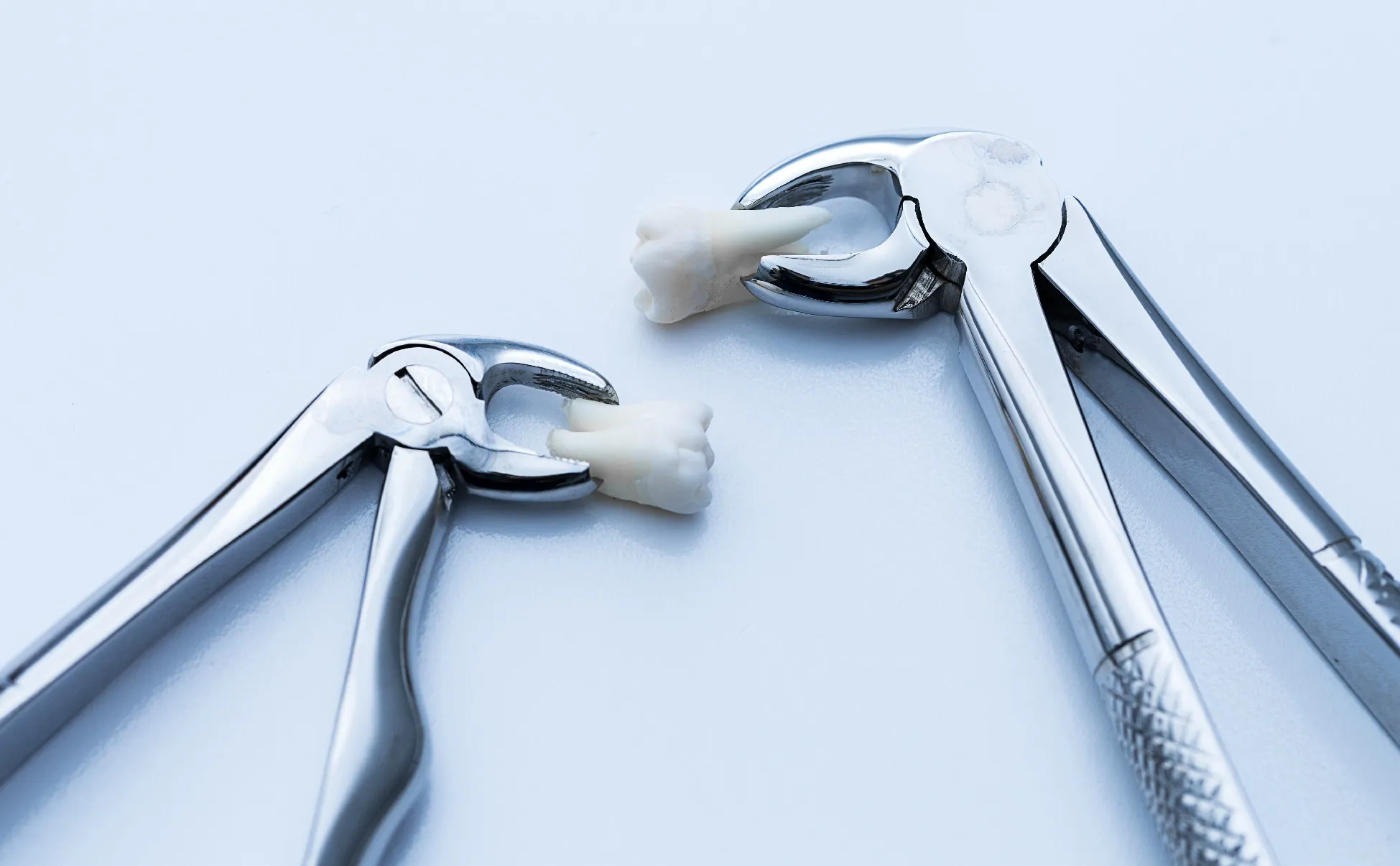 خلع الاسنان