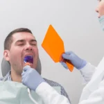 تجميل الأسنان المهشمة