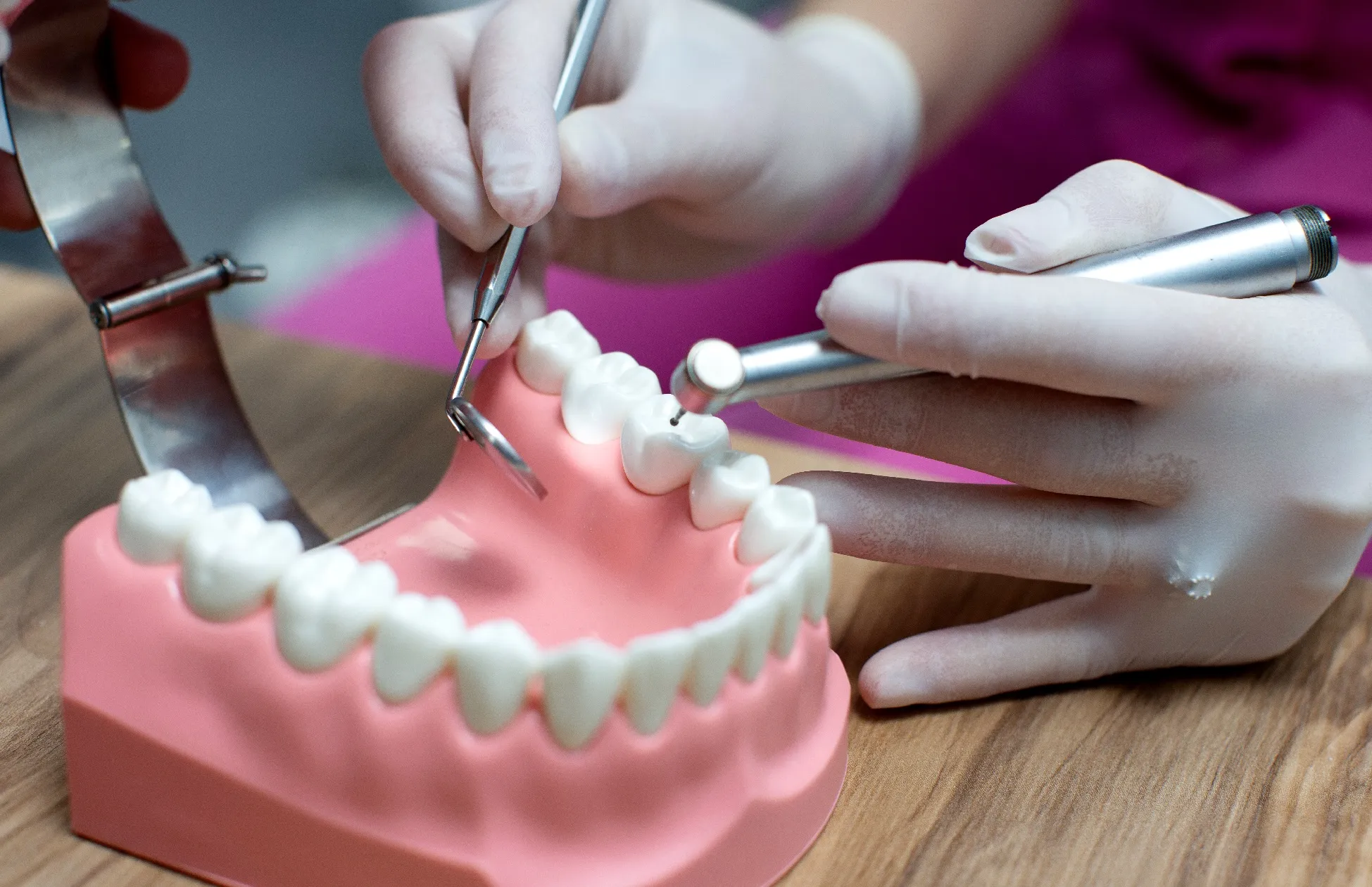 زراعة الأسنان