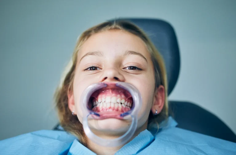 إعادة تأهيل الفم بالكامل