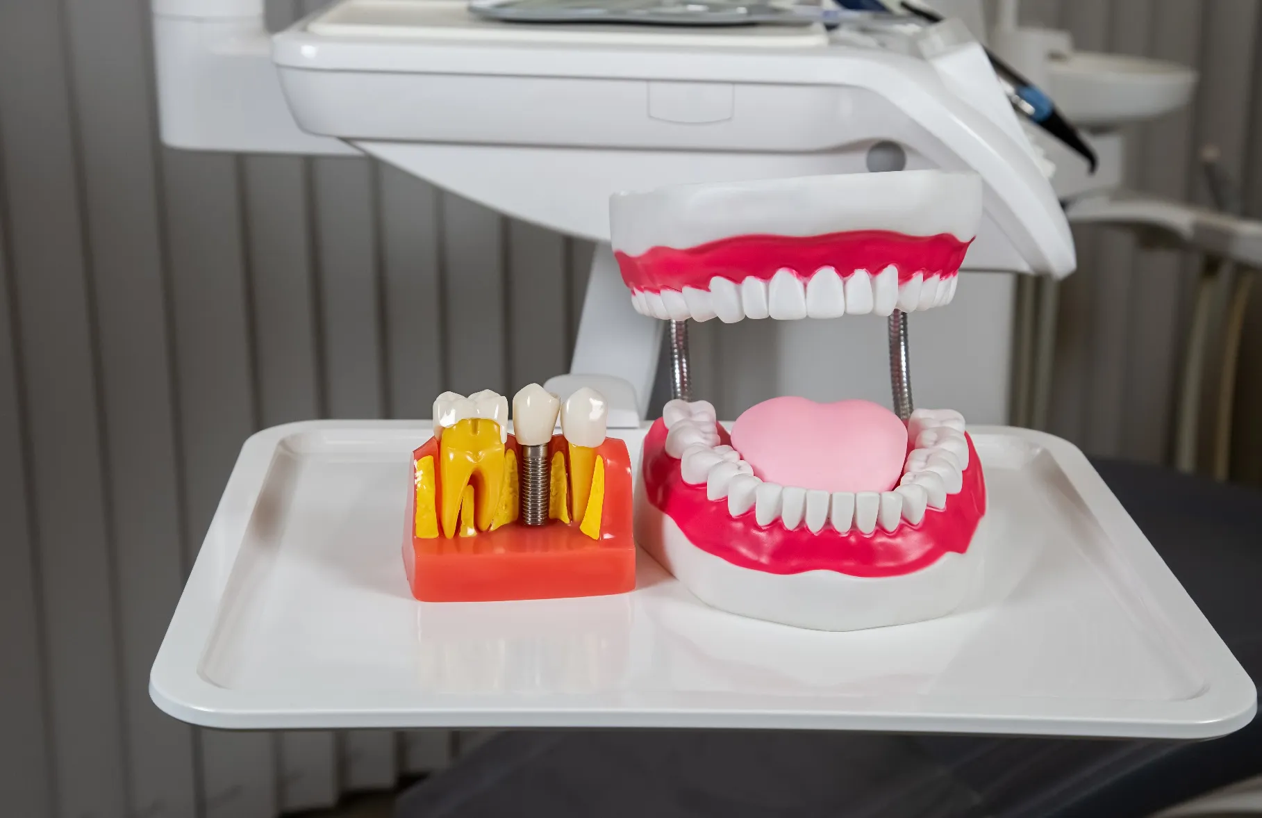 الفرق ما بين السيراميك والزيركون