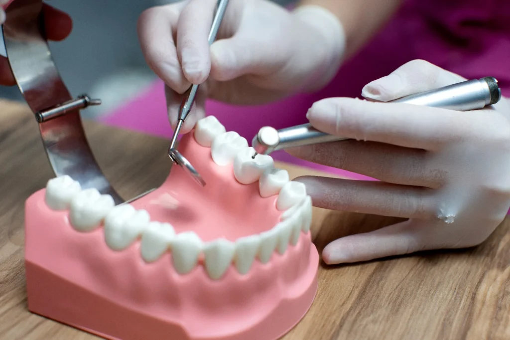 تركيبات الأسنان