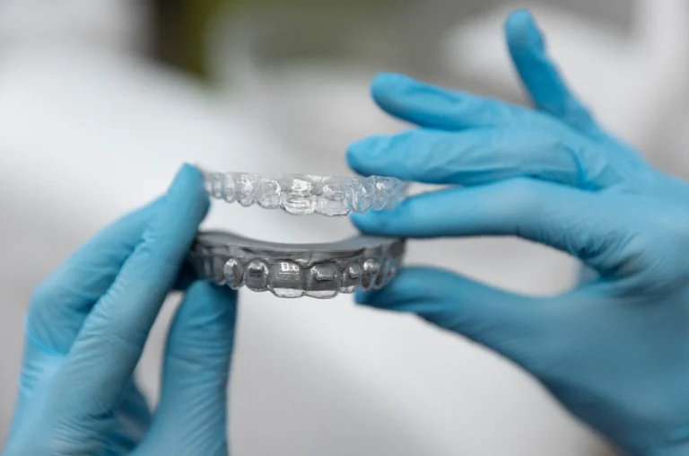 تقويم الأسنان اللاصق خلف الأسنان