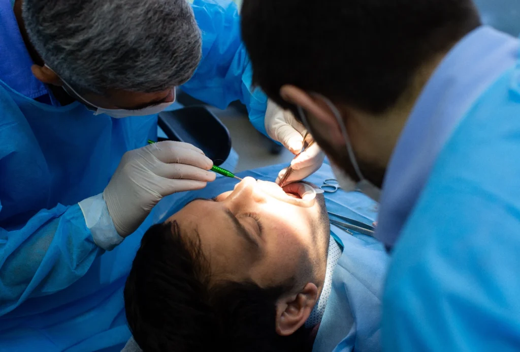 زرع عصب الاسنان