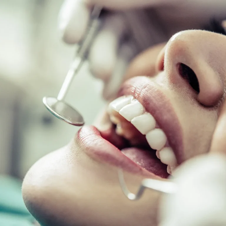 أفضل أنواع تلبيسة الأسنان