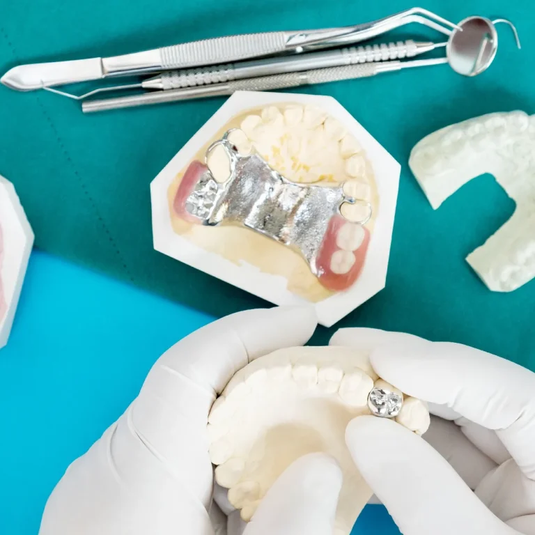 أفضل أنواع زراعة الأسنان