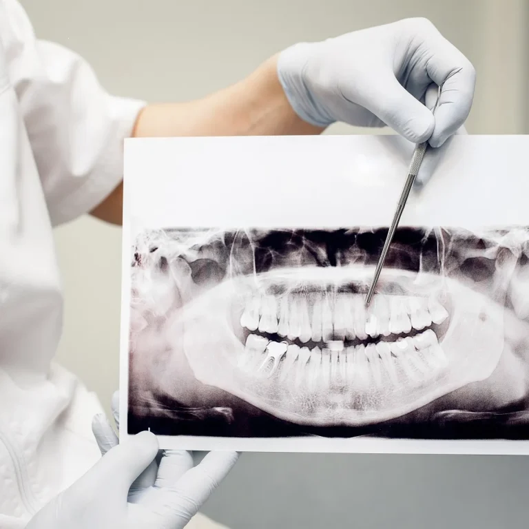 أمراض الأسنان
