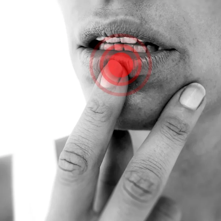 أنواع أمراض الفم