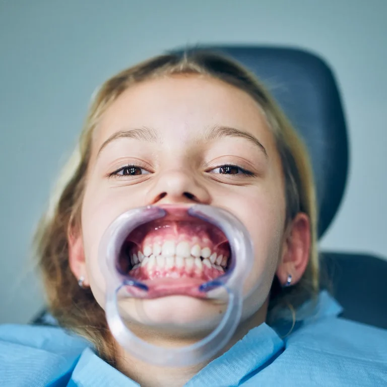 إعادة تأهيل الفم بالكامل