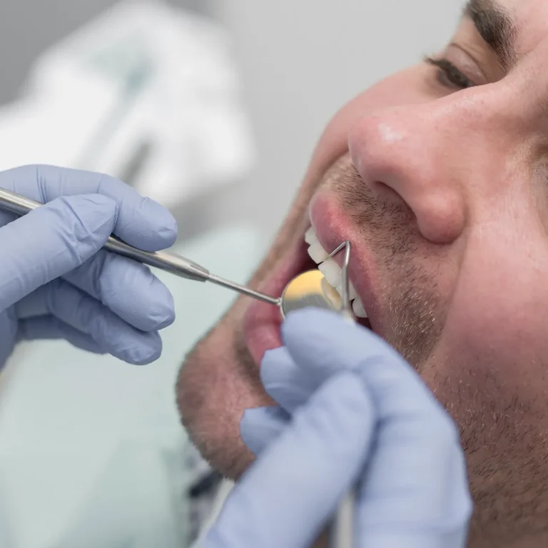 اضرار ضرس العقل