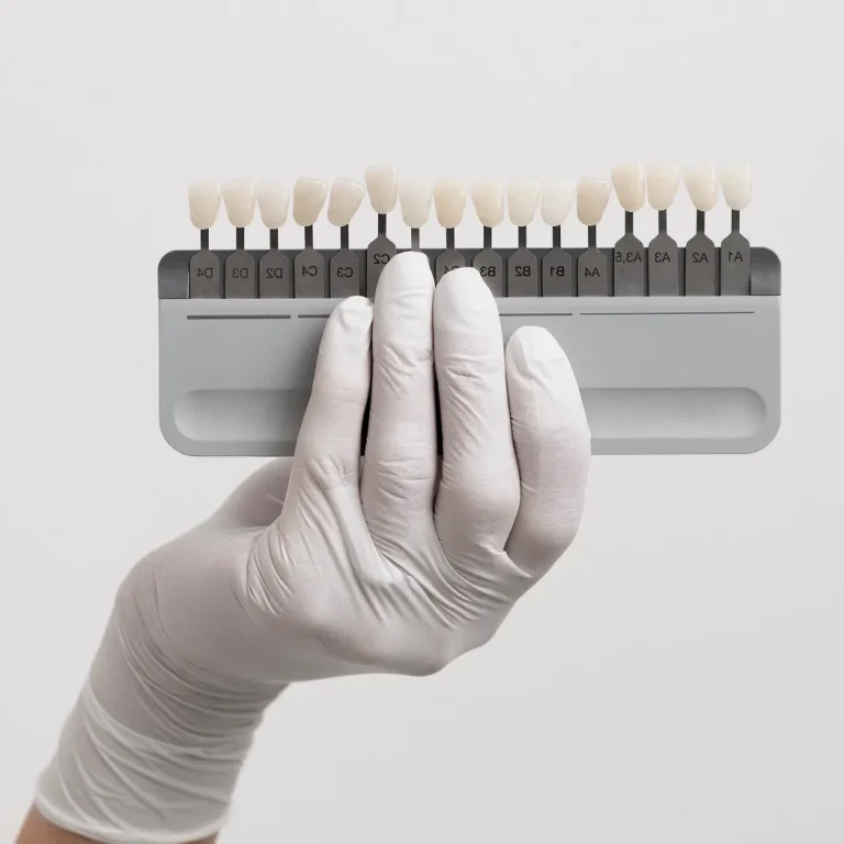 الفينير واللومنير