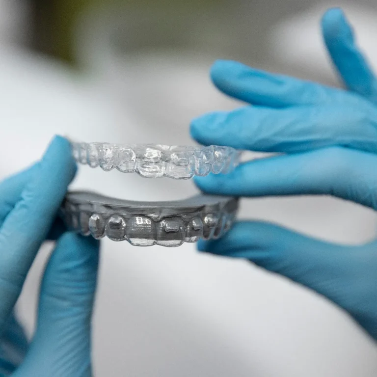 تقويم الأسنان اللاصق خلف الأسنان