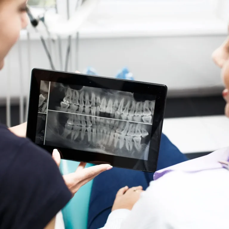 ضرس العقل المدفون